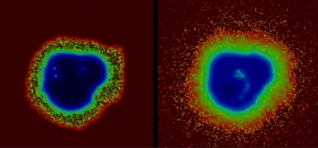 ACCESS allocations on Anvil at Purdue and Expanse at SDSC were used to show how computational modeling allows researchers to determine the best drug combinations for TB treatment. This image is a screenshot from a video comparing the treatment effectiveness as shown under a microscope.